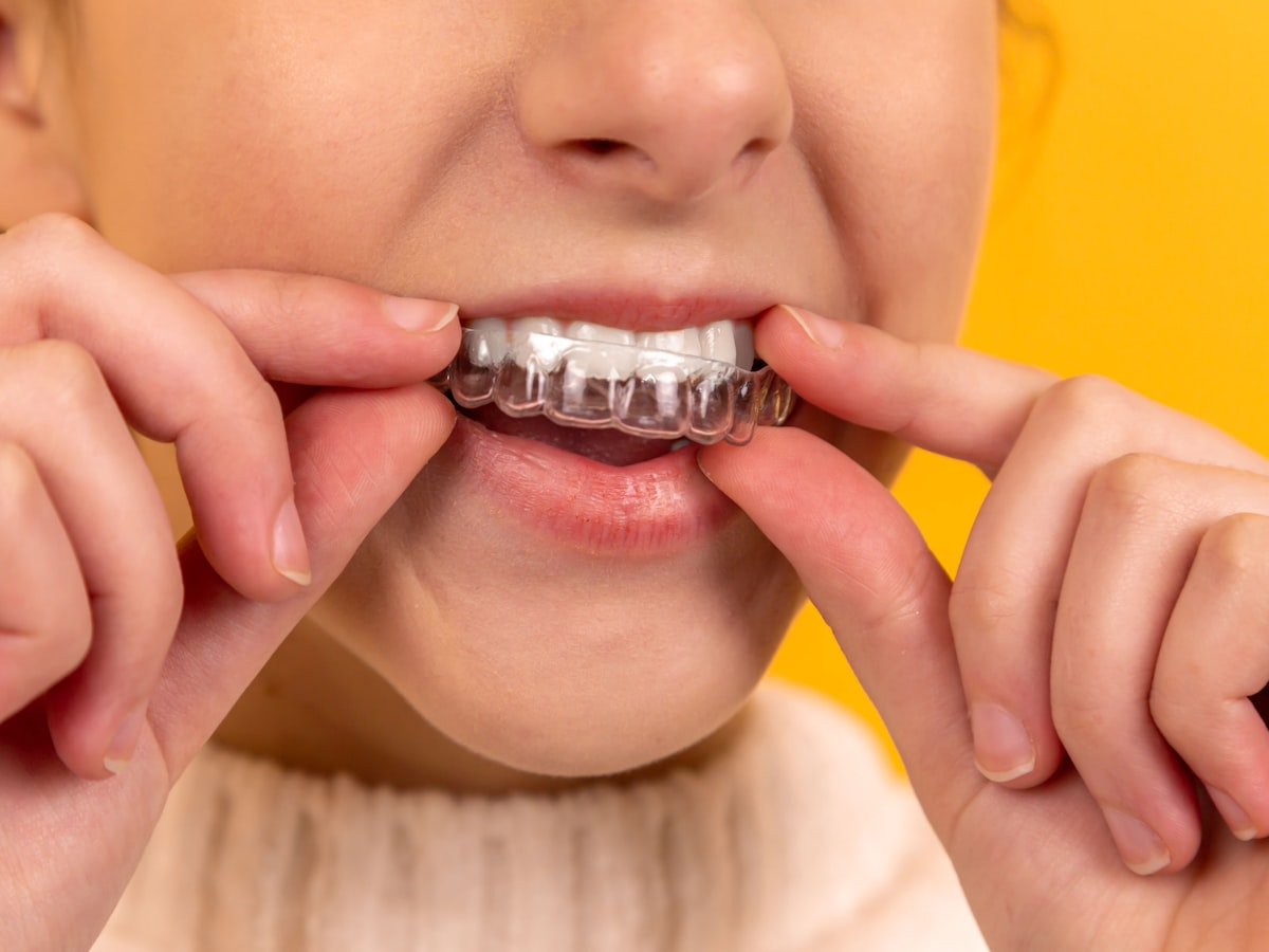 A clear aligner tray being fitted over upper teeth, against a yellow background
