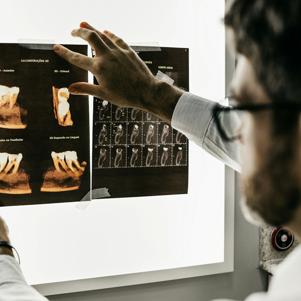 A dentist studying 3D dental scans on a lightbox